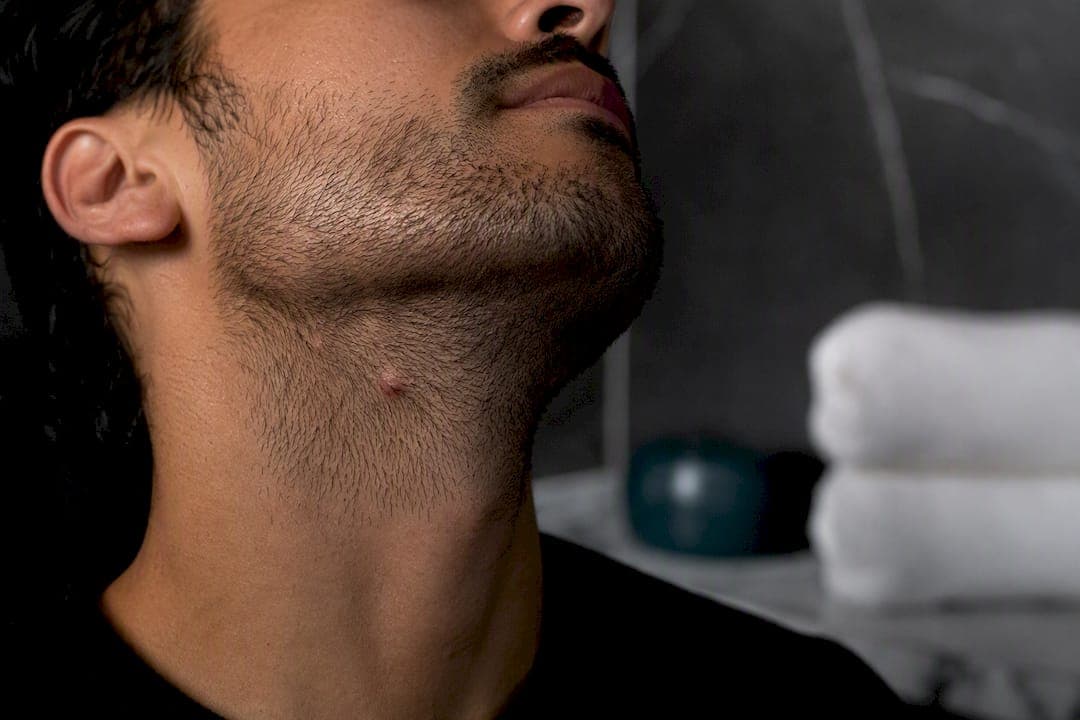 Stop recurring ingrown hairs under the beard in 1–6 months for men