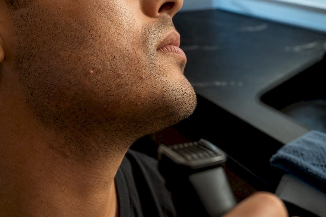 Clear Men's Razor Bumps in Days, Or See a Clinician After 3–4 Weeks