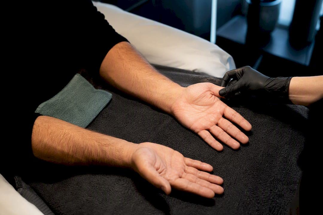Men's sweaty hands: Clinic tested Botox cuts palm sweat for six months