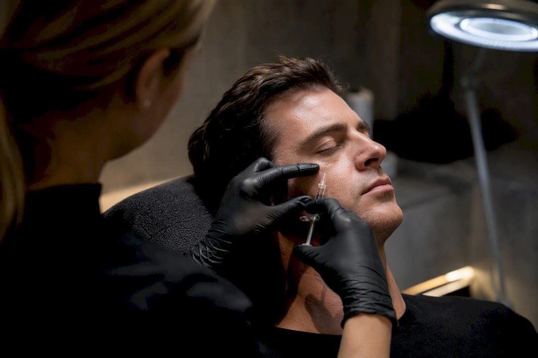 Polynucleotide injections for men: under eye gains peak at 3 months
