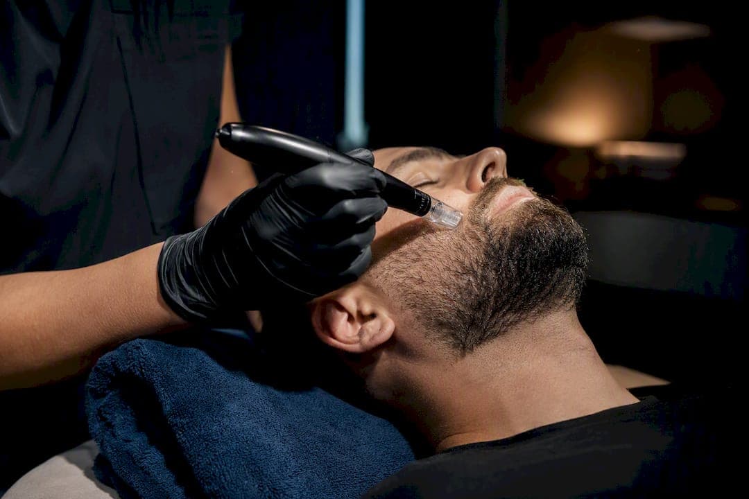 24 Hour Rule and 12 Week Reality: Microneedling for Men’s Beard Growth