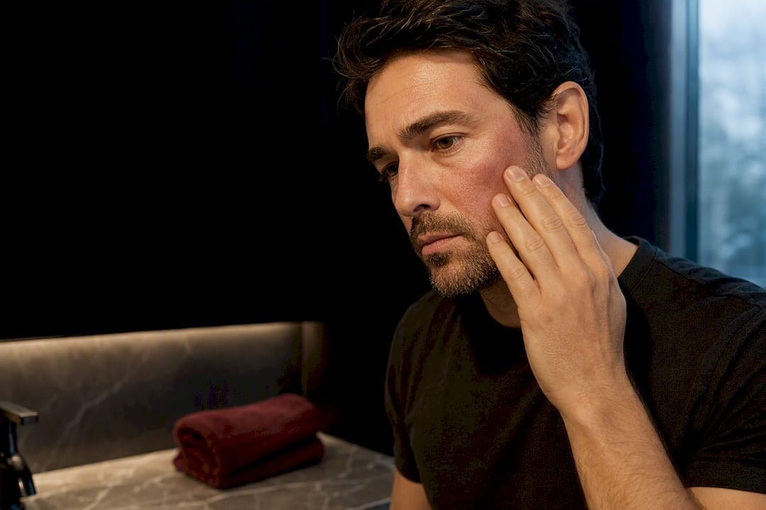 24–72 Hours Red After Microneedling: What Men Should Expect