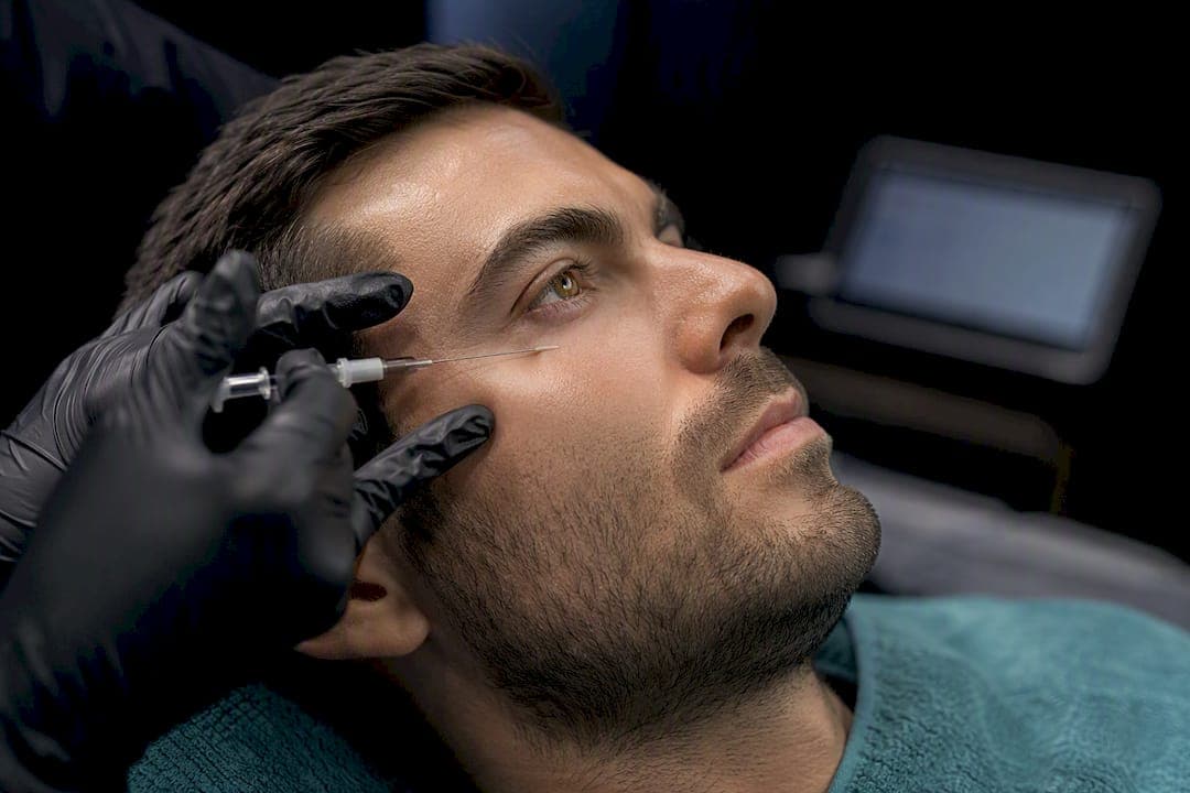 Men: Clinic view on under eye polynucleotide injections, 2–3 sessions