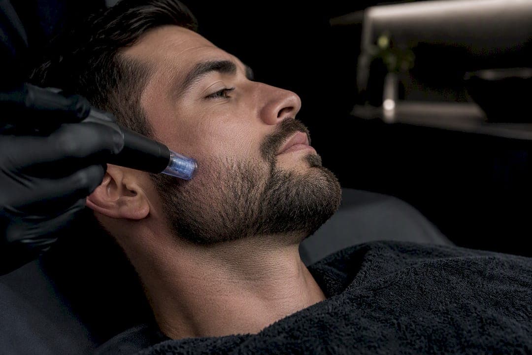 First Week Timeline for Beard Microneedling: Day 1 Gel, 48–72h Shave