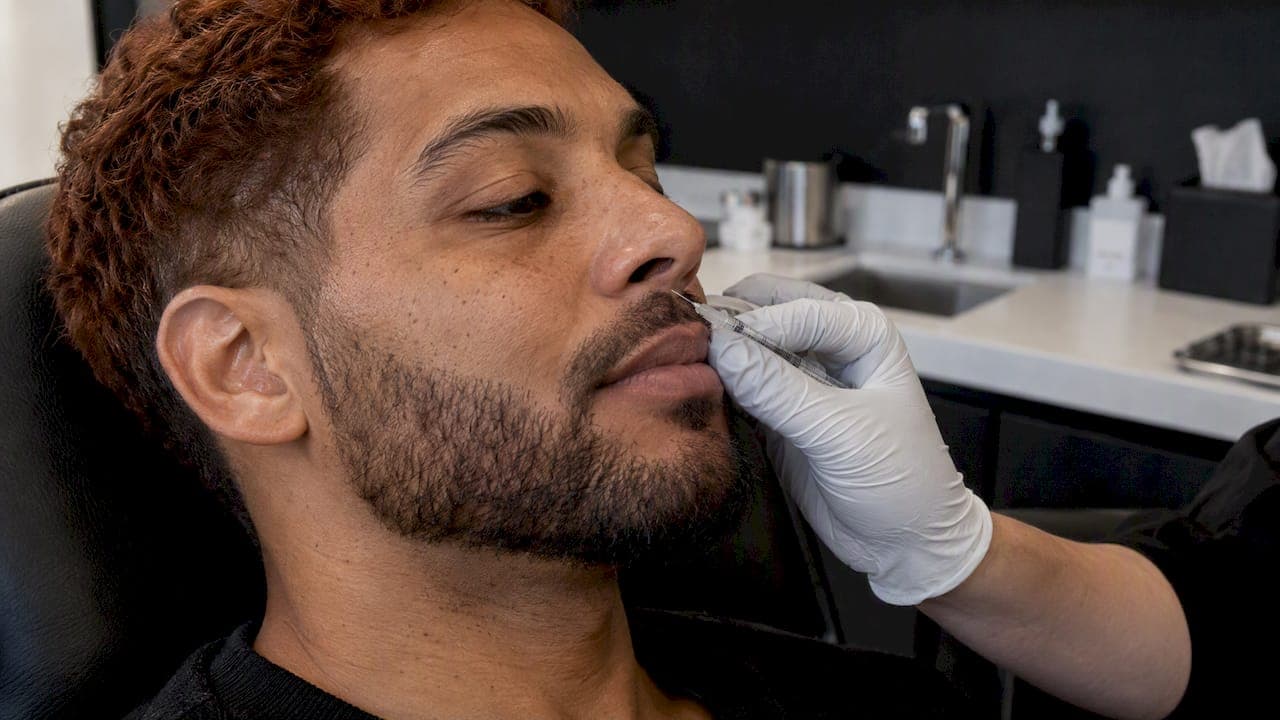 Lip Flip for Men: What It Does, What to Expect